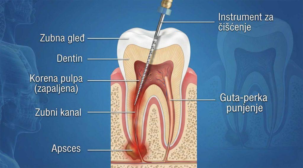 Grafički prikaz zuba i njegovih slojeva